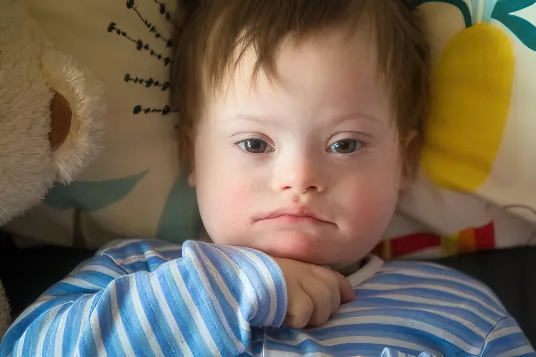 sindrome down 1